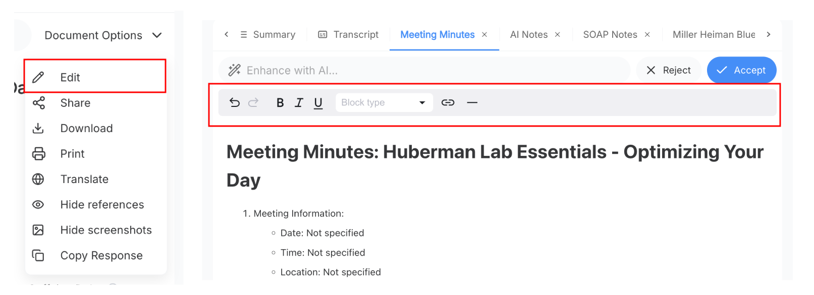 Edit and review generated SOP
